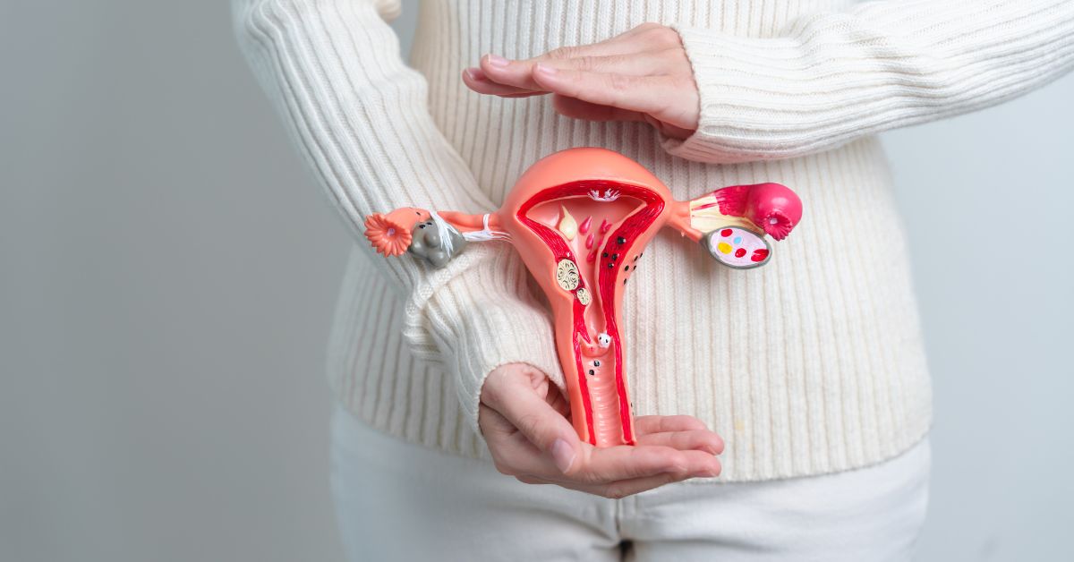 fibroid rahim