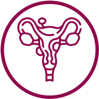 fibroid
