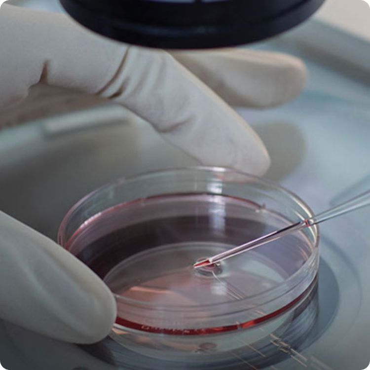 ikhtiar kehamilan melalui kaedah ivf 