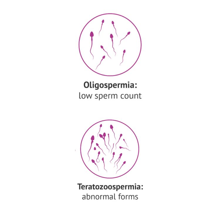 kualiti sperma lelaki di malaysia menurun