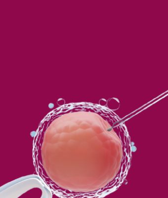 IVF In-Vitro Fertilization